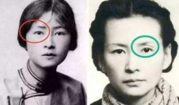 蒋诗萌爆料整容视频,揭秘明星整形背后的真相